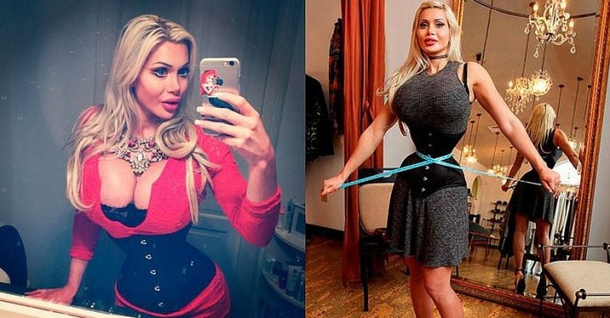 Женщина удалила шесть ребер, чтобы достигнуть безупречной внешности